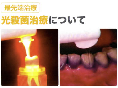 光殺菌治療について